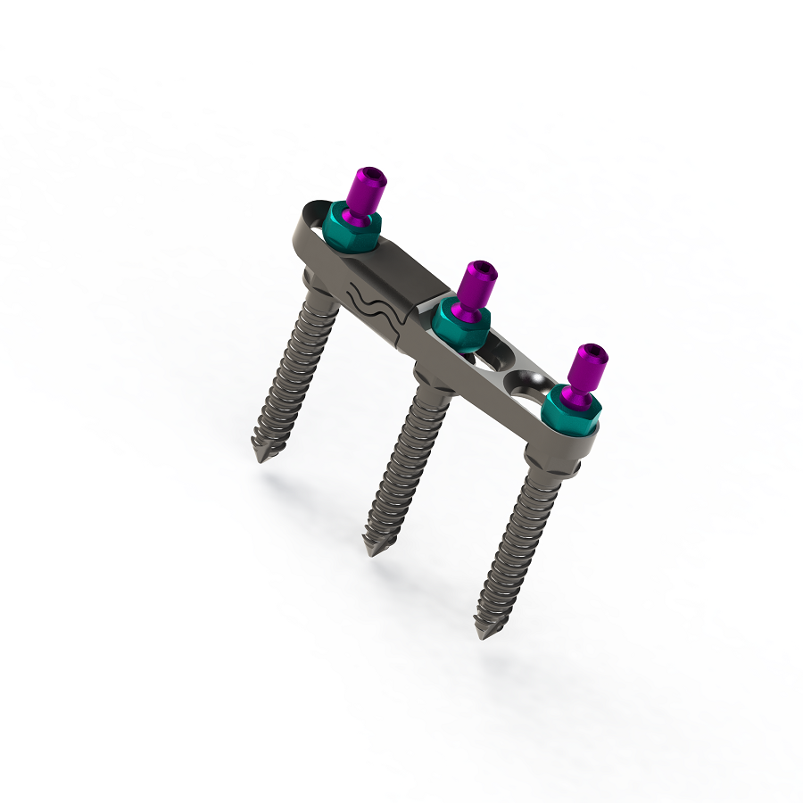 ADITUS DYNAMIC PLATE SYSTEM