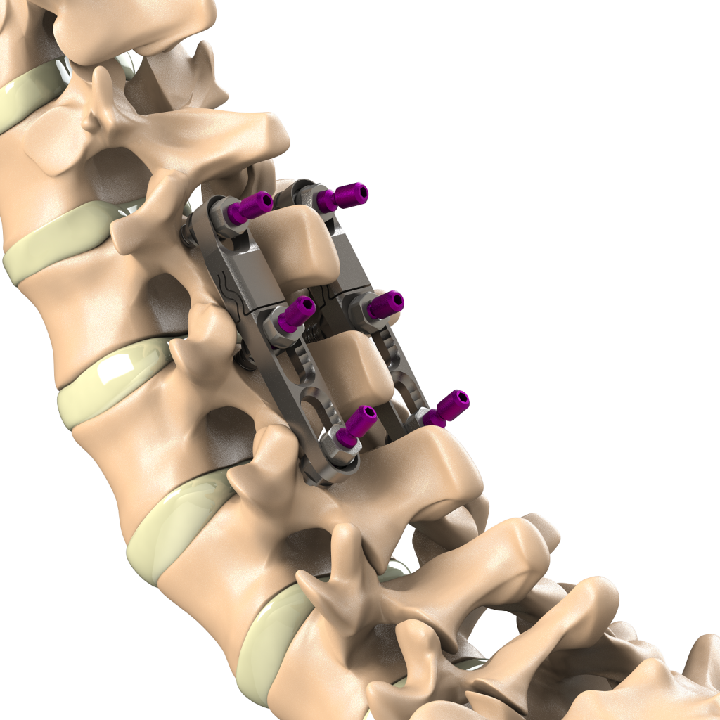 ADITUS DYNAMIC PLATE SYSTEM
