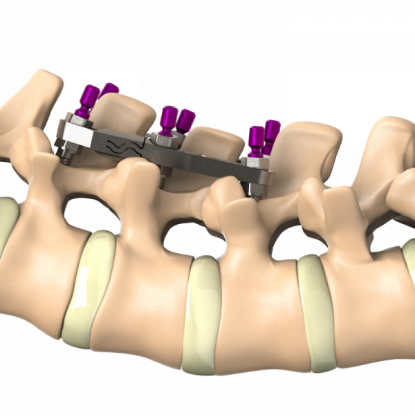 ADITUS DYNAMIC PLATE SYSTEM