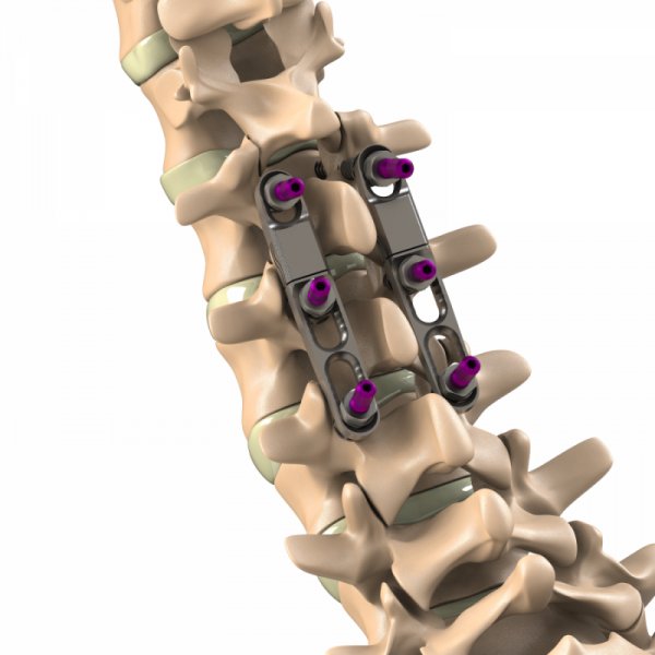 ADITUS DYNAMIC PLATE SYSTEM