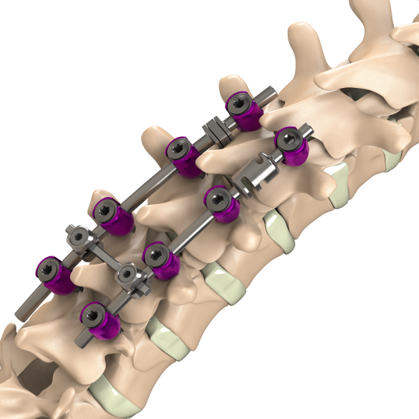 ADITUS DYNAMIC ROD SYSTEM