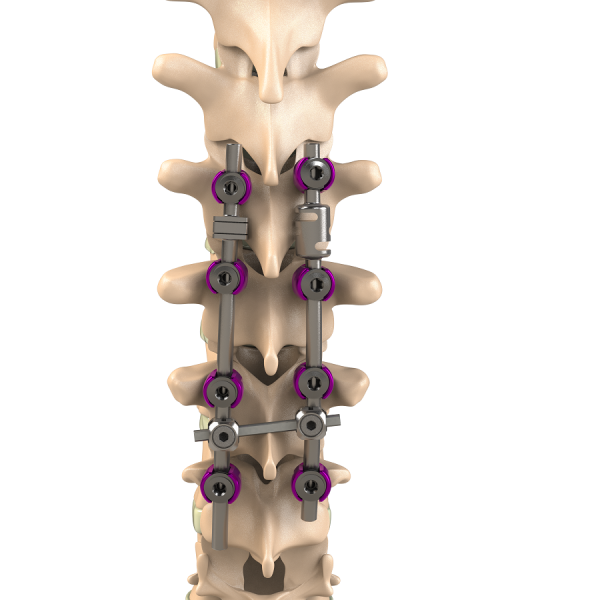 ADITUS DYNAMIC ROD SYSTEM