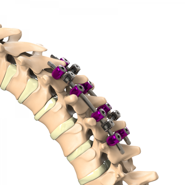 ADITUS SPINAL STABILIZATION SYSTEM