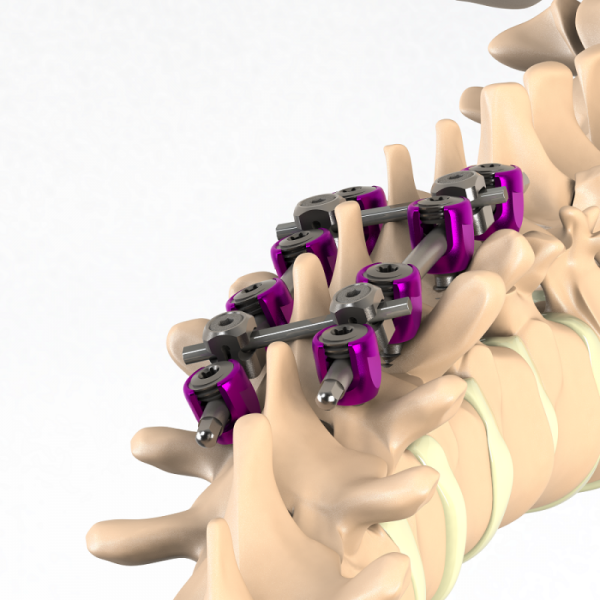 ADITUS SPINAL STABILIZATION SYSTEM