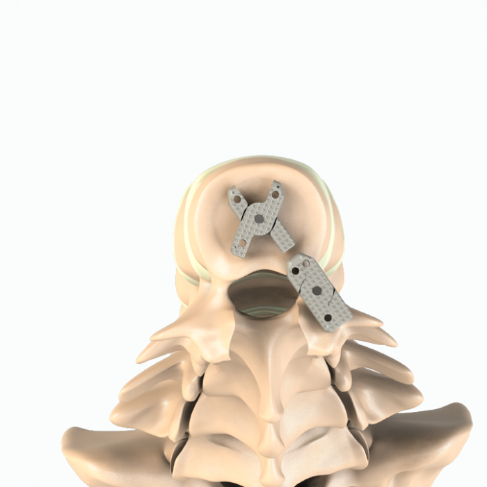 ADITUS LUMBAR XLIF CAGE