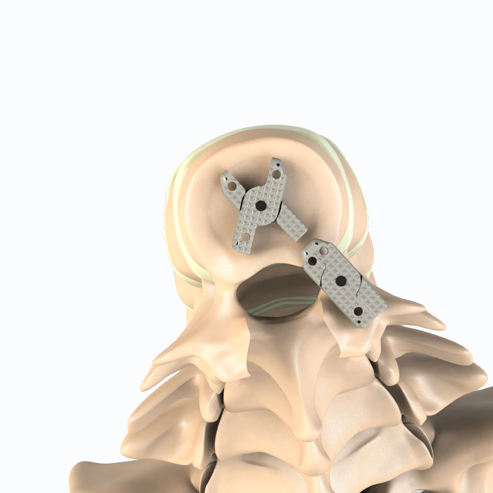 ADITUS LUMBAR XLIF CAGE