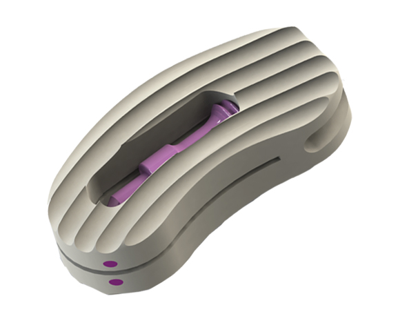 ADITUS LUMBAR TLIF CAGE