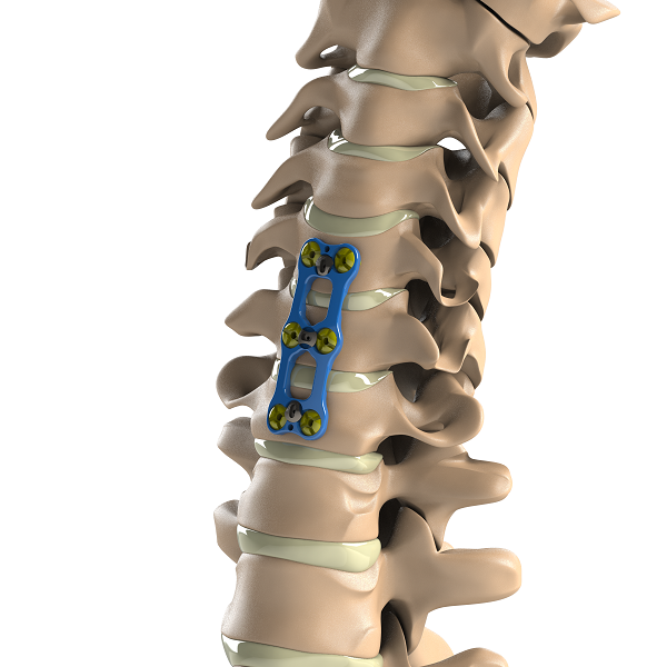 ADITUS ANTERIOR CERVICAL PLATE SYSTEM