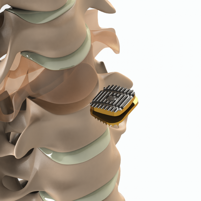 ADITUS CERVICAL DISC PROSTHESIS